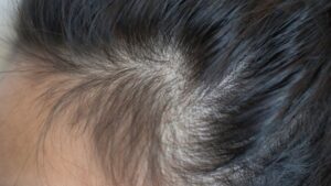 Hair Vitals | Complete Ayurvedic Hair Solution photo review