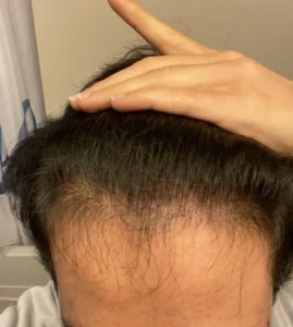 Hair Vitals | Complete Ayurvedic Hair Solution photo review